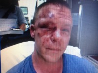 Former Marine Brutally Beaten While Defending Teen from Bullies