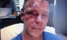 Former Marine Brutally Beaten While Defending Teen from Bullies