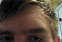 Polish Immigrant Commits Suicide Due to Bullying